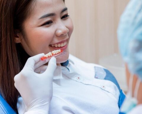 Smile Enhancements Using Custom Ceramic Facings