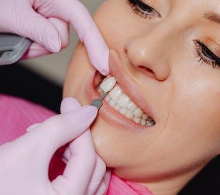 veneers can effectively mask stains